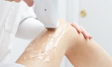 Курсы лазерной эпиляции в онлайн